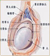 睪丸炎